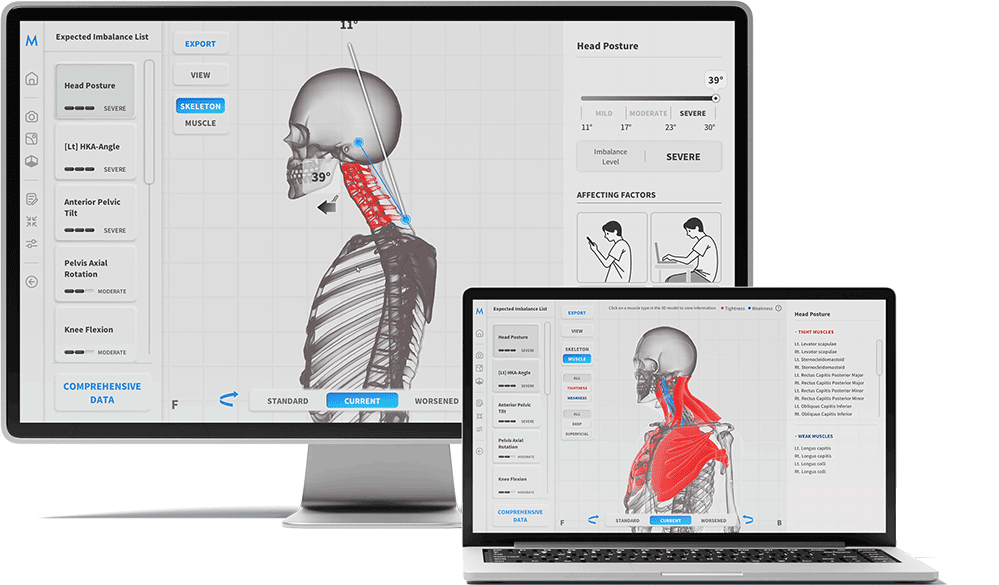 3D Haltungsscanner Moti Physio Main