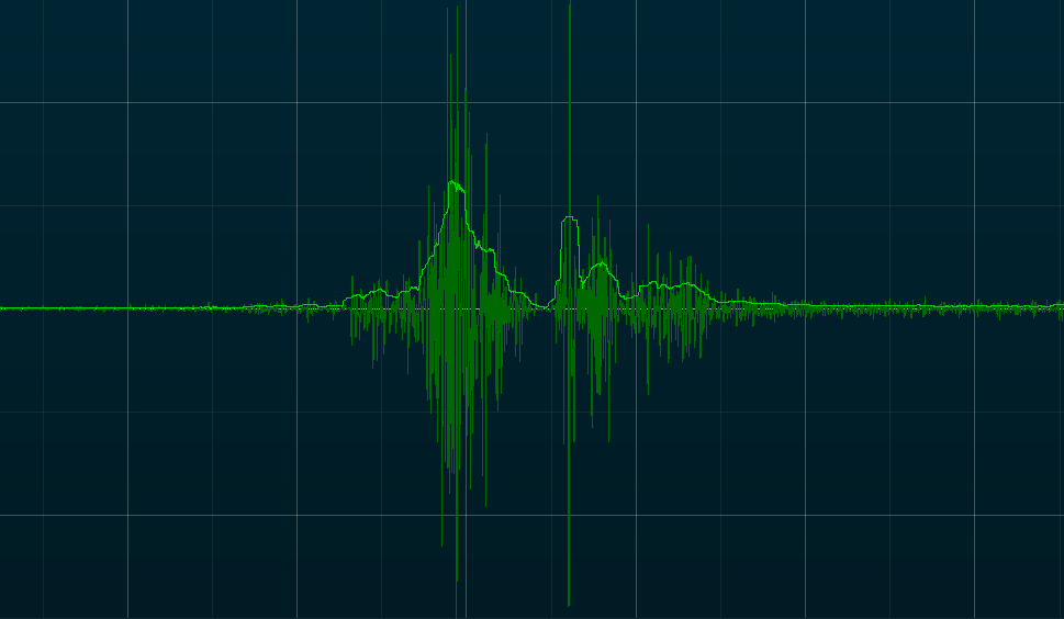 EMG Rohsignal