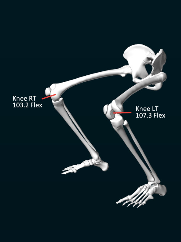 3D Bewegungsanalyse