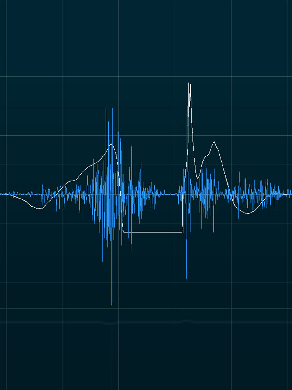 EMG Analyse