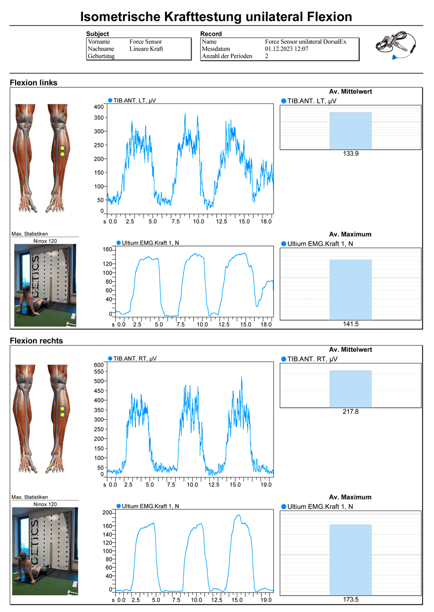 EMG Kraftsensor Report 1