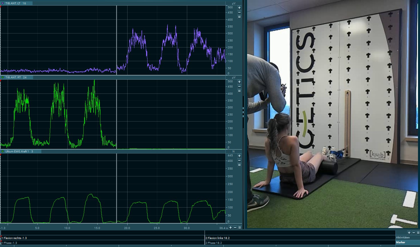 Kraftmessung mit EMG-Sensor